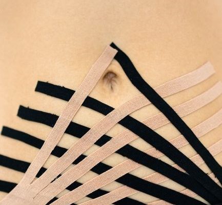 diastasis recti physiotherapy exercises pdf
